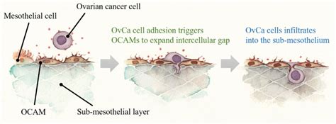 Cancers | Free Full-Text | Ovarian Cancer-Associated Mesothelial Cells ...