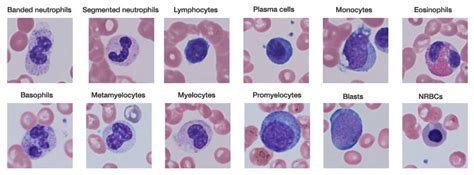 Forms of Leukocytes | Medical Laboratories