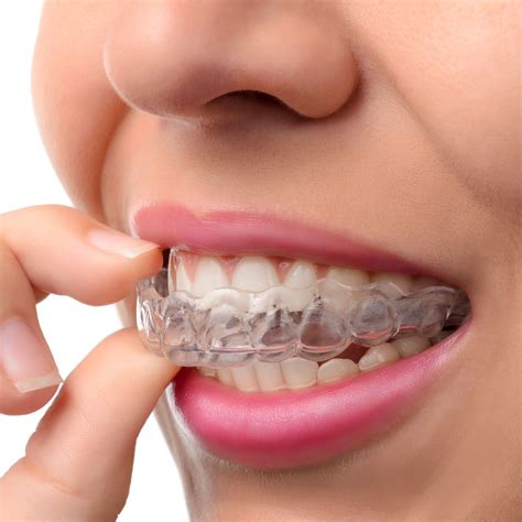 How Long Does It Take to Adjust to Invisalign® Aligners? - Austin, TX