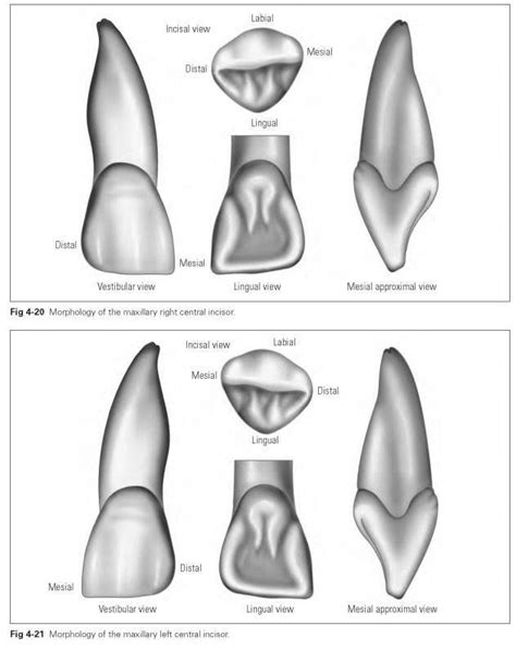 Maxillary incisors - Dental Technology: How-To, Tips - #Dental #HowTo # ...