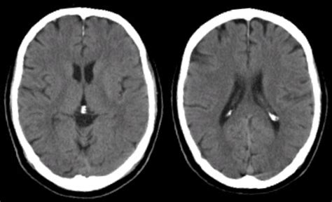 What Does A Ct Scan Look Like