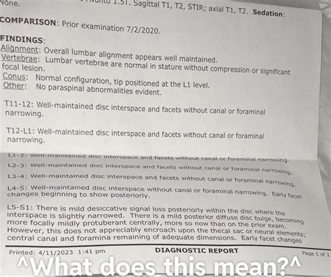 MRI RESULTS : r/Sciatica