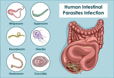 Whipworm Infections: Causes, Symptoms, and Treatments - Facty Health