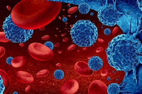 Turning the Lens on Hematologic Malignancies - Leading Discoveries Magazine