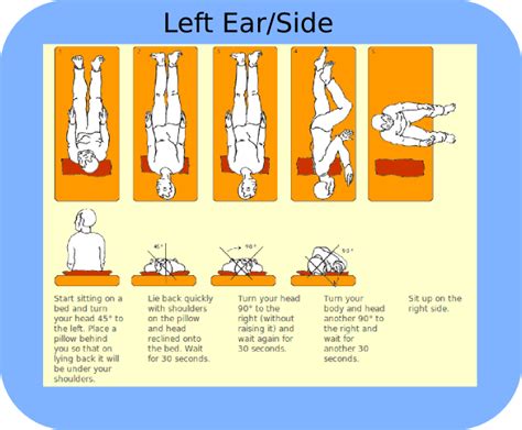 Epley Maneuver | Tampa Bay Hearing and Balance Center