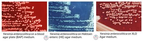 Yersinia enterocolitica Food Poisoning (Yersiniosis)