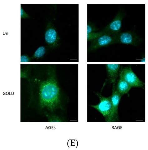 Antioxidants | Free Full-Text | Glyoxal-Lysine Dimer, an Advanced ...