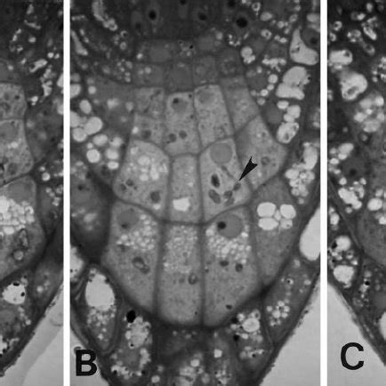 Central columella cell (inside-“right”) after reorientation of the ...