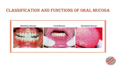 Classification & Functions of Oral Mucosa| Oral Mucous Membrane| # ...