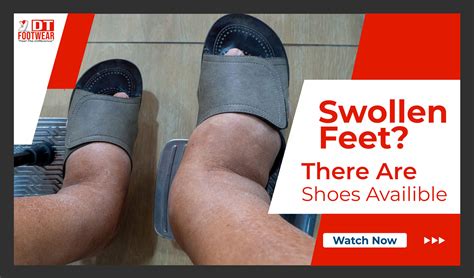 Shoes For Swollen Feet - They're Availible!