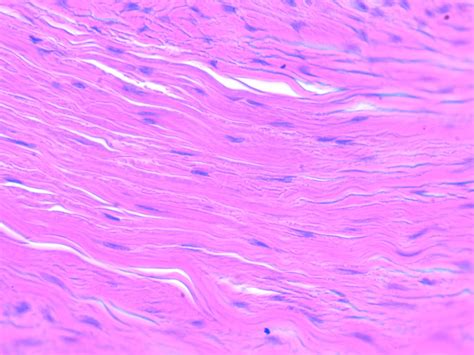 Dense regular connective tissue - Medically