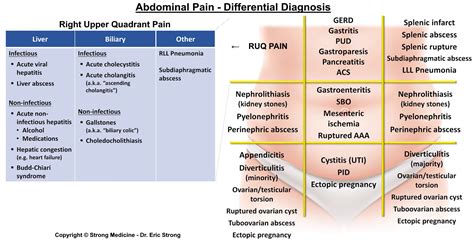 Causes Of Right Upper Quadrant Pain