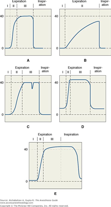 Chapter 43. Capnography | The Anesthesia Guide | AccessAnesthesiology ...