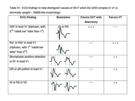 Differential Diagnosis of Wide QRS Complex Tachycardias - The Clinical ...