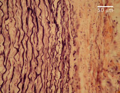 Histology Of Aorta