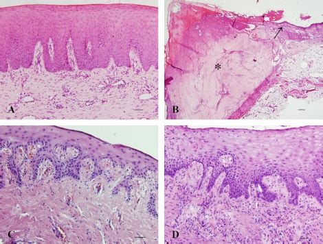 Histology Of Gingiva