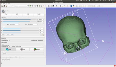 Exploring DICOM Images With 3D Slicer | Thejesh GN