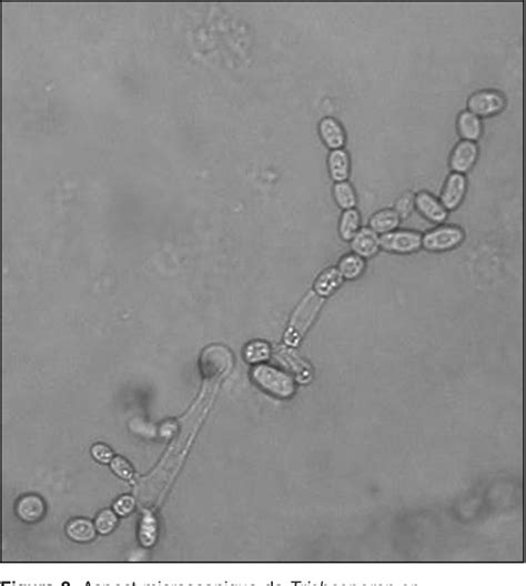 [PDF] [Disseminated Trichosporon asahii infection]. | Semantic Scholar