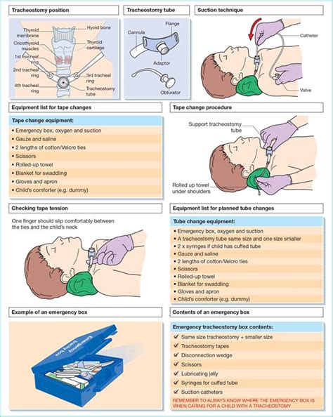 Tracheostomy care | Nurse Key