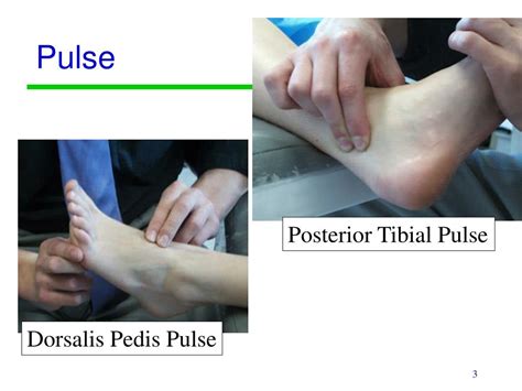 Posterior tibial and dorsalis pedis pulses