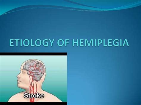 Etiology of hemiplegia