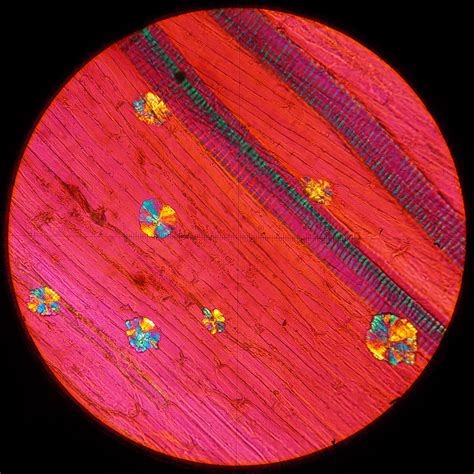 Polarized light microscopy - Lin Yangchen