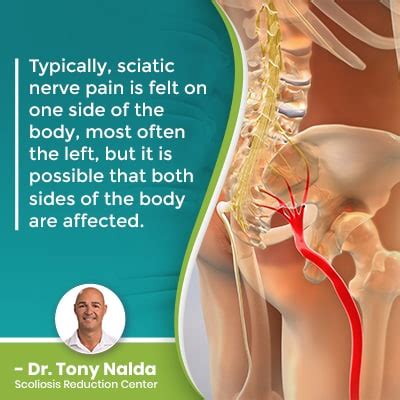 What Will The Hospital Do For Sciatica Pain? Anything?