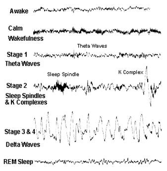 Sleep Stages and EEG : Mnemonic | Epomedicine