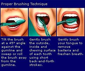 Tooth & Gums: Brushing Technique