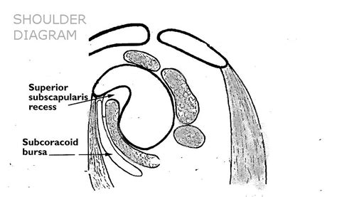 Subcoracoid-Subscapularis Bursa MRI - Sumer's Radiology Blog