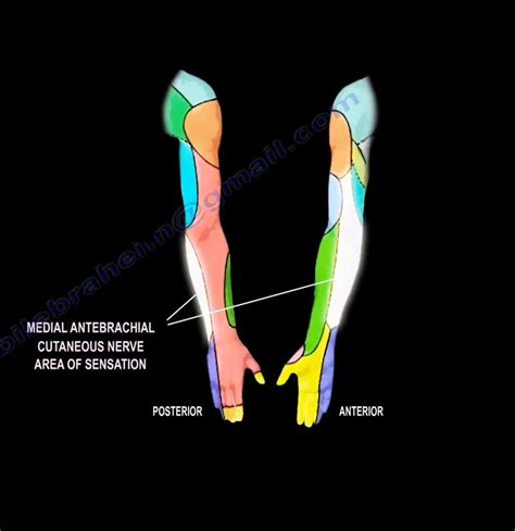 Medial Antebrachial Cutaneous Nerve Injury — OrthopaedicPrinciples.com