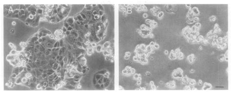 The role of the vitronectin receptor in cell spreading and attachment ...