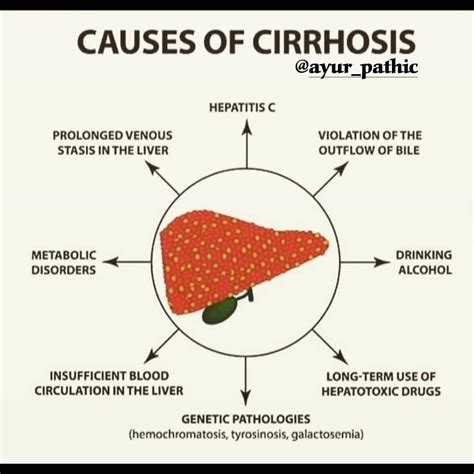 Liver Cirrhosis Complications