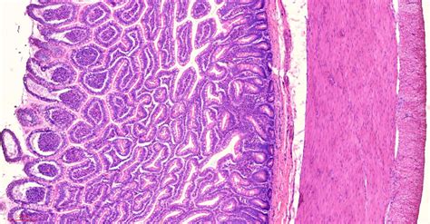 Human ileum cross-section histology slides, 7 µm sec., H&E Stain, human ...