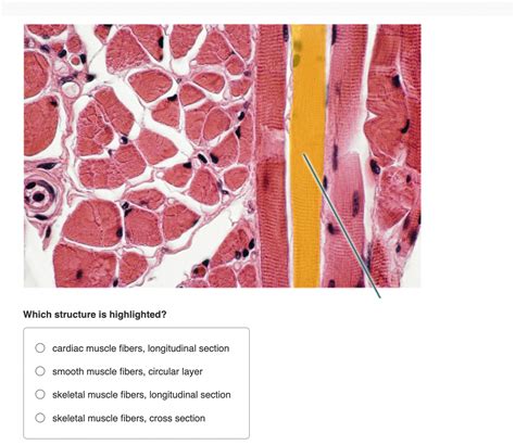 Solved Which structure is highlighted?cardiac muscle fibers, | Chegg.com