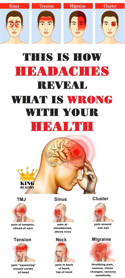 This is How Headaches Reveal What is Wrong With Your Health - King ...