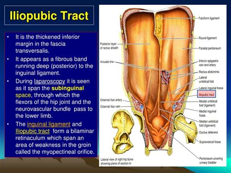 PPT - A nterolateral A bdominal Wall A nd PowerPoint Presentation, free ...