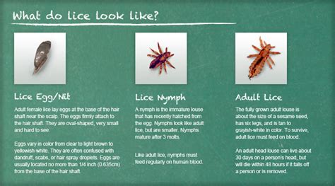 How To Recognize Lice | Lice Removal and Treatment | Ladibugs Clinic