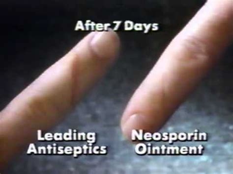 Dramatic Cuts Neosporin Ointment Commercial, 1991 - YouTube