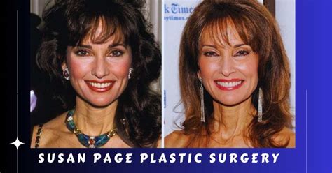 Susan Page Plastic Surgery: A Journey Towards Renewed Confidence ...