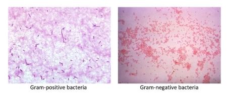 Gram Negative Cocci Bacteria