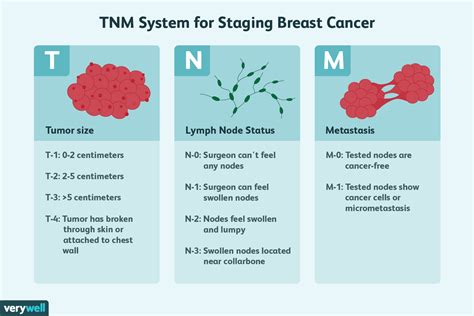 Breast Cancer Tumor Size and Stage