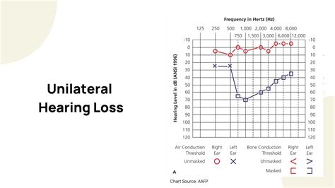 How to Read an Audiogram | Dr. Amy Sarow Explains