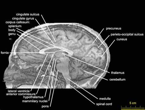 Sagittal level 0182 as MRI