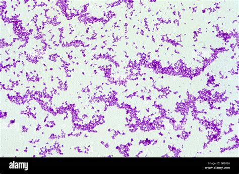 Corynebacterium Gram Stain