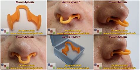 Can Anti-Snoring Nose Devices Stop Snoring Alone?