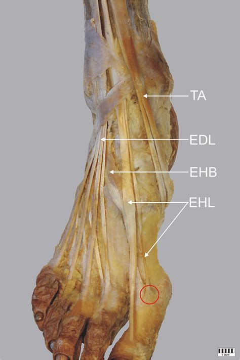 boşluk dil daha fazla m extensor hallucis brevis seni kızdırmak diğer ...