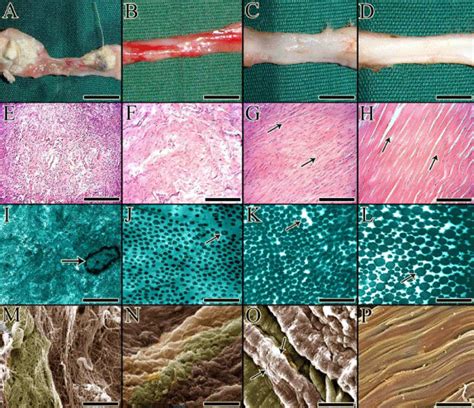 Figure 3: Three different stages of tendon healing under gross ...