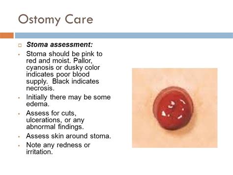 The Opening And Closing Of Stoma Is Regulated By - Printable Templates ...