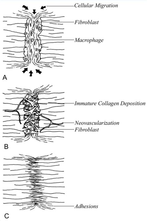 Phases of tendon healing. The different phases that occur in response ...